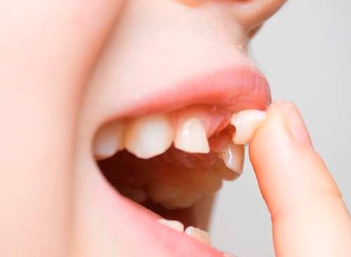 Qué significa soñar con dientes flojos